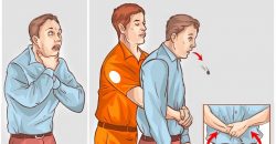 Heimlich Manevrası Nedir? Önemi